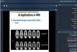 گزارش تصویری کارگاه هوش مصنوعی در MRI